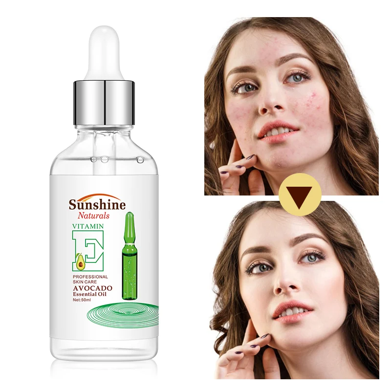 factory direct support OEM Pretty cowry avocado essential oil 100% pure facial moisturizing hydration Avocado essential oil
factory direct support OEM Pretty cowry avocado essential oil 100% pure facial moisturizing hydration Avocado essential oil