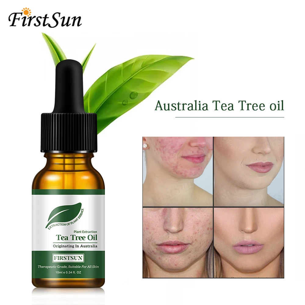 Bulk Wholesale Skin Care 100% Pure Tea Tree Oil Essential for Skin Whitening Oil Control Moisturizing Acne Treatment 
Bulk Wholesale Skin Care 100% Pure Tea Tree Oil Essential for Skin Whitening Oil Control Moisturizing Acne Treatment