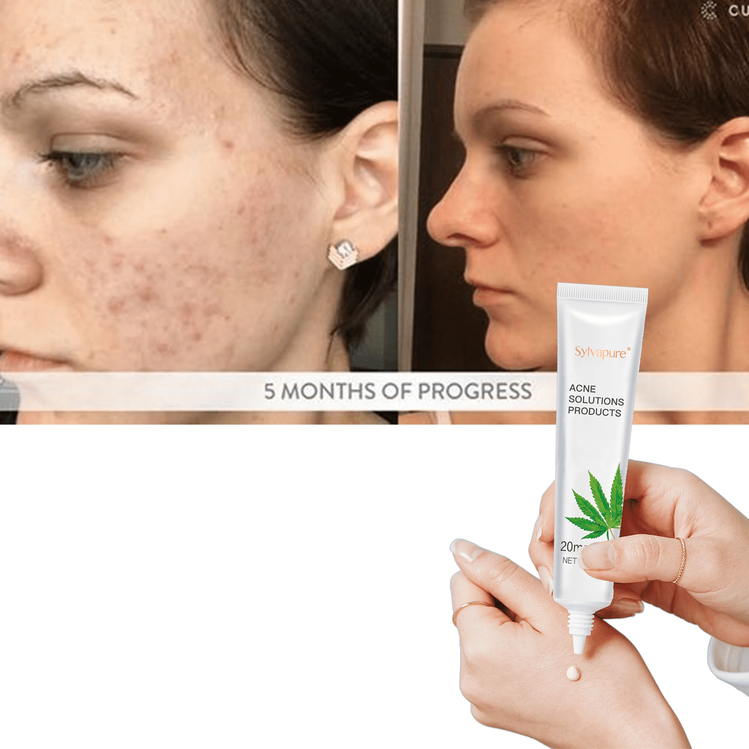 Organic Skin Care scar removal Whitening Facial Moisturizing acne Cream with private label, Milk white
Organic Skin Care scar removal Whitening Facial Moisturizing acne Cream with private label, Milk white