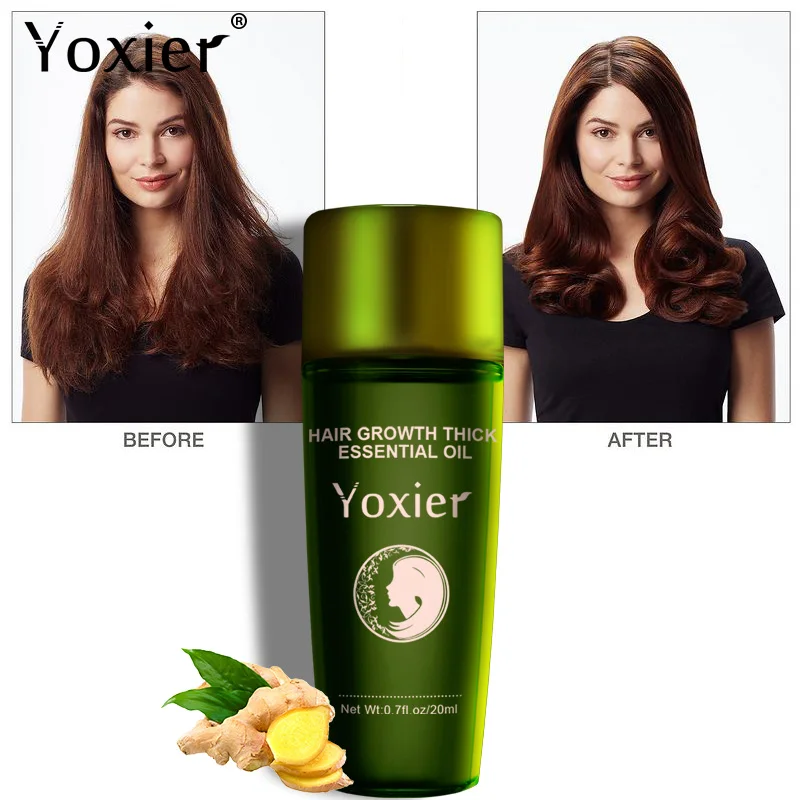 Yoxier Fast Repair Growing Treatment Hair Growth Oil Women Men ginger Hair Oil Growth Hair Growth Oil
Yoxier Fast Repair Growing Treatment Hair Growth Oil Women Men ginger Hair Oil Growth Hair Growth Oil
