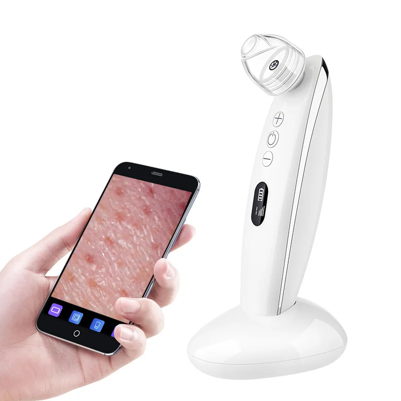 Electric visual blackhead suction device instrument for household use Acne removal beauty Pore cleansing artifact
Electric visual blackhead suction device instrument for household use Acne removal beauty Pore cleansing artifact