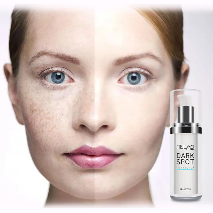 Hot selling dark spot corrector serum face for correcting glow spots remover removing melanin vitamin c
Hot selling dark spot corrector serum face for correcting glow spots remover removing melanin vitamin c