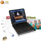Best quality 4d cheapest portable ultrasound machine color Doppler PW CW function
