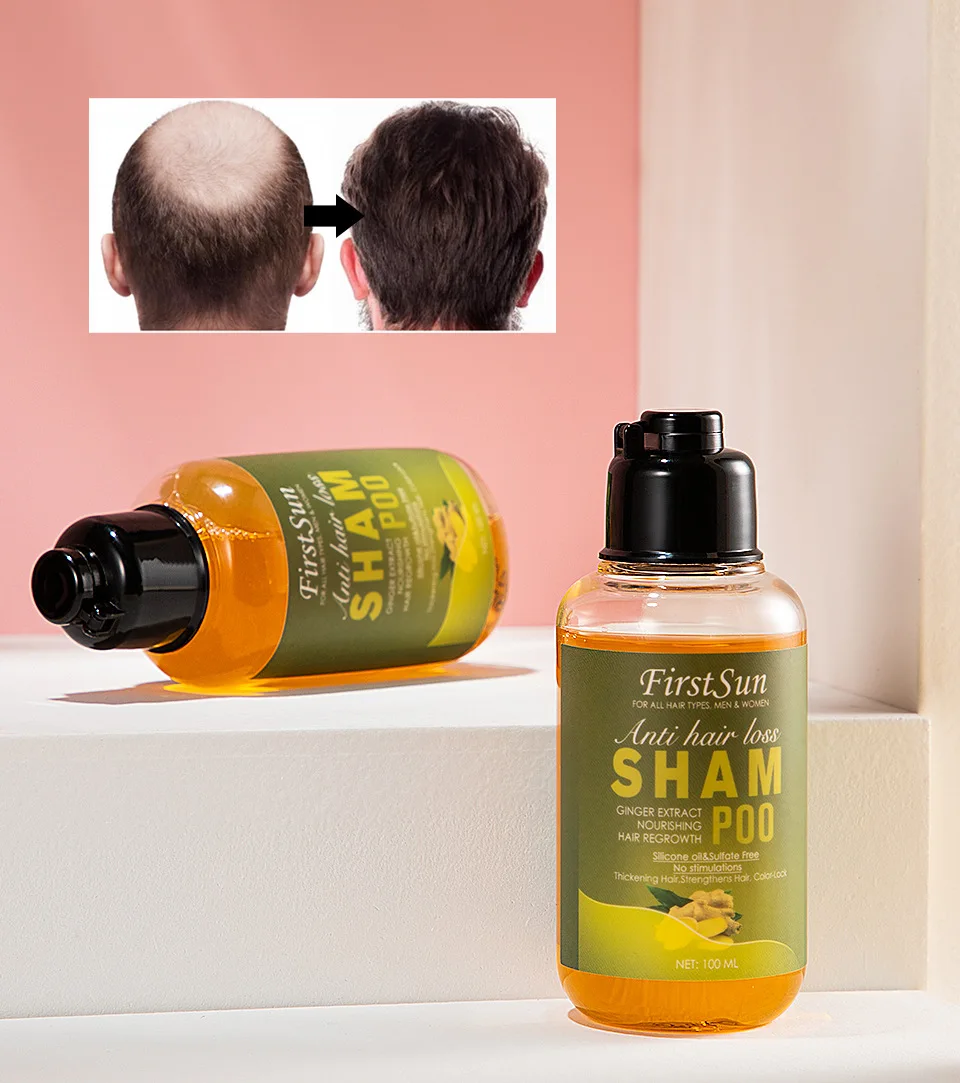 High Quality Organic Anti-pruritic Smooth Moisturizing Hair Anti Loss Hair Growth Old Ginger Shampoo
High Quality Organic Anti-pruritic Smooth Moisturizing Hair Anti Loss Hair Growth Old Ginger Shampoo