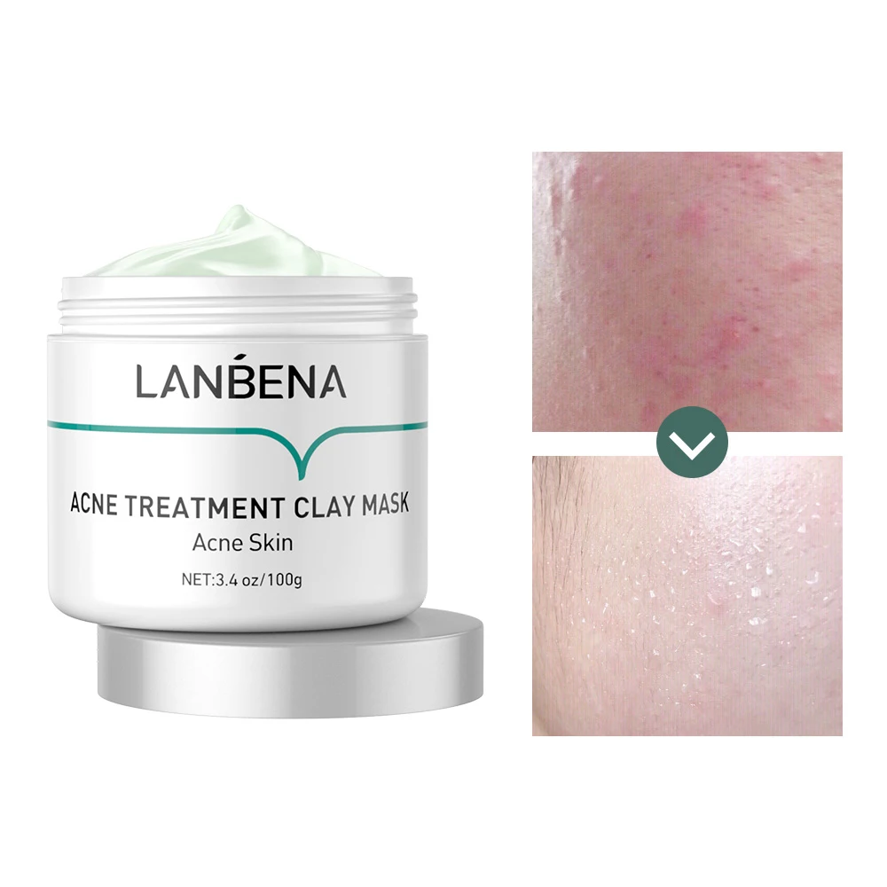 LANBENA new beauty anti-acne mask sheet summer essential moisturizing anti-aging mask hot sale
LANBENA new beauty anti-acne mask sheet summer essential moisturizing anti-aging mask hot sale
