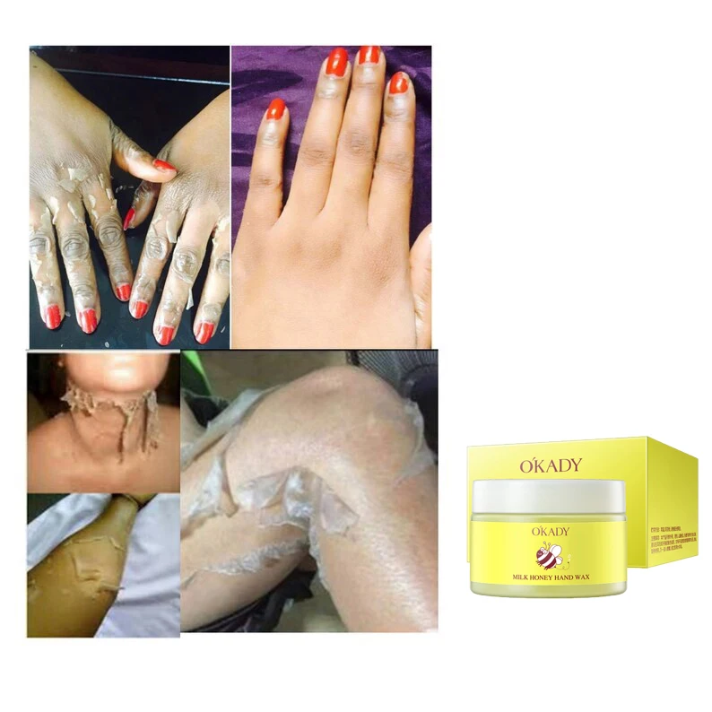 Peeling Body Lotion Natural Dark Knuckles Remove Yellow Peeling Oil Extra Strength Whitening Yellow Peeling Lotion
Peeling Body Lotion Natural Dark Knuckles Remove Yellow Peeling Oil Extra Strength Whitening Yellow Peeling Lotion