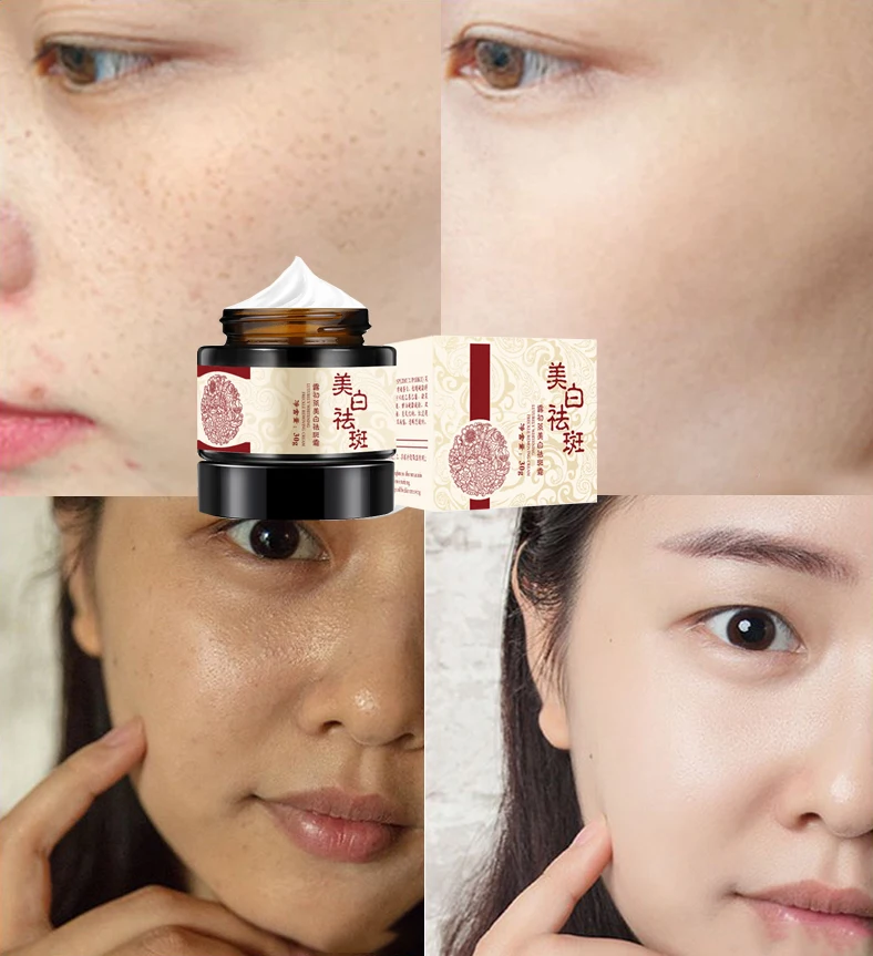 Whitening and freckle cream 30g dilute the stain, senile spot, chloasma, whitening cream cr
Whitening and freckle cream 30g dilute the stain, senile spot, chloasma, whitening cream cr
