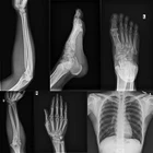 Medical X Ray Maya Medical Digital Portable X Ray Machine Price For Human Limbs Checking