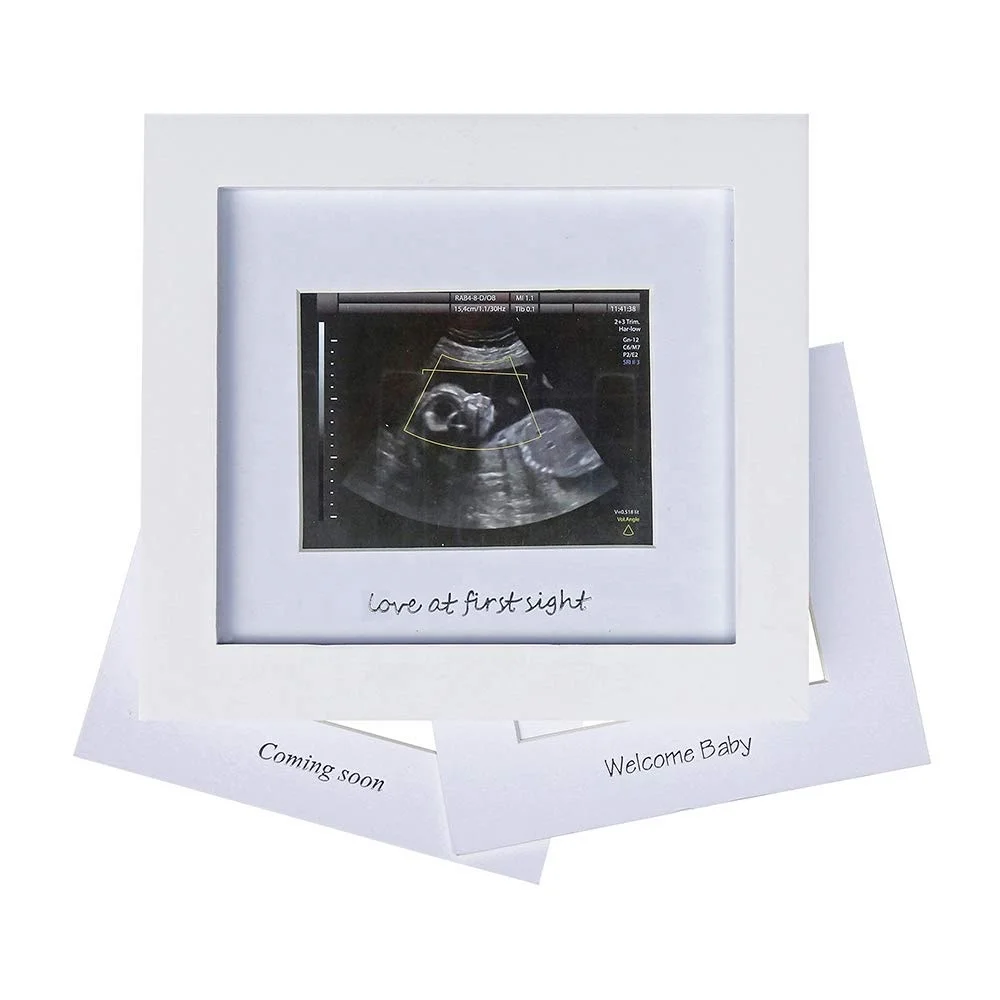 Hot selling 1st Ultrasound Picture Frame Idea Gift for Expecting Parents Baby Shower Baby Sonogram Photo Frame
Hot selling 1st Ultrasound Picture Frame Idea Gift for Expecting Parents Baby Shower Baby Sonogram Photo Frame