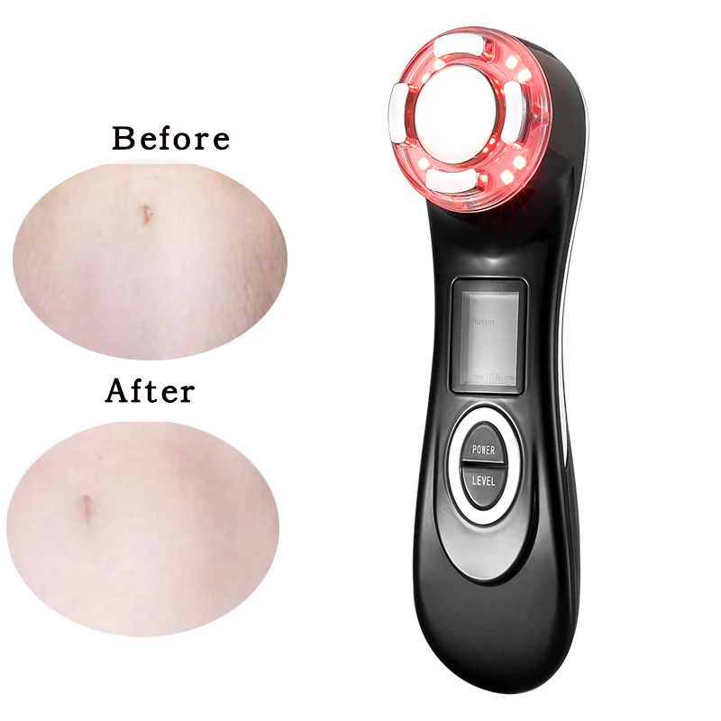 new portable stretch marks laser machine home use portable treatment stretch marks skin repair, White, black, pink
new portable stretch marks laser machine home use portable treatment stretch marks skin repair, White, black, pink