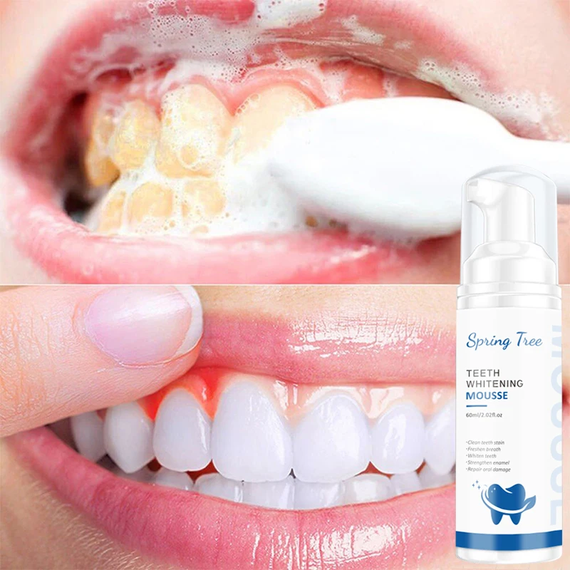 2021 New Product Oral Hygiene Spotless Stains Remover Shining Confident Smile Teeth Whitening Mousse
2021 New Product Oral Hygiene Spotless Stains Remover Shining Confident Smile Teeth Whitening Mousse