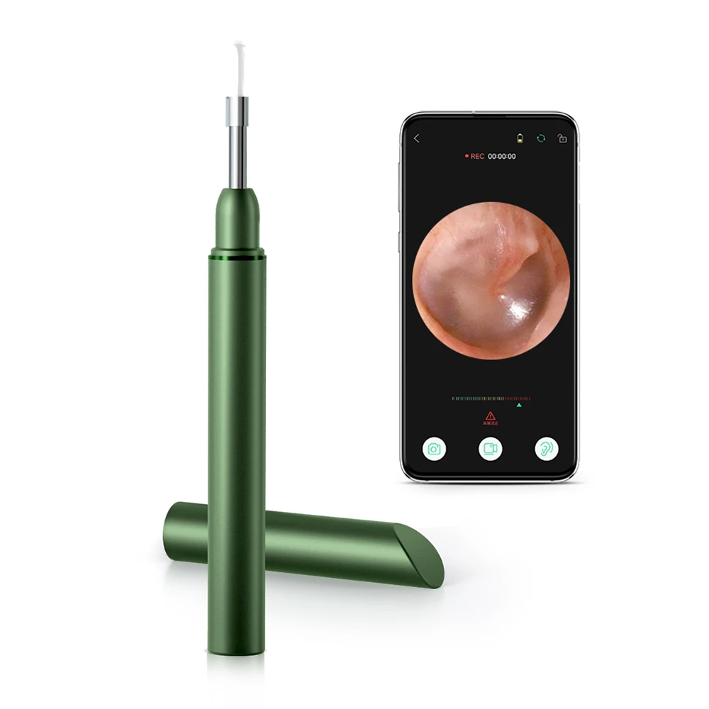 Timesiso P42 wifi three layers friendly materials earwax removal endoscope earwax tool earwax cleaner scope
Timesiso P42 wifi three layers friendly materials earwax removal endoscope earwax tool earwax cleaner scope