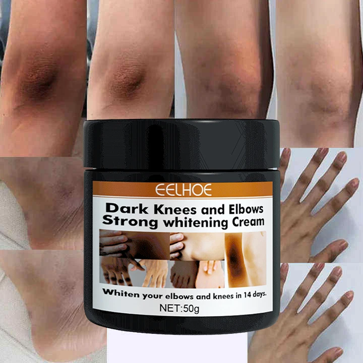 Strong Effective Dark Knuckles Remover Cream Powerful Whitening Cream Hand knuckle Cream for Elbow and Knee Black Skin
Strong Effective Dark Knuckles Remover Cream Powerful Whitening Cream Hand knuckle Cream for Elbow and Knee Black Skin