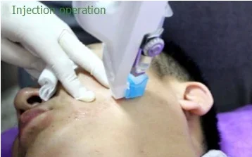 Hot selling Korea 5pin 9 pin multineedle mesotherapy gun Vital injector 1 and 2  Mesotherapy Gun