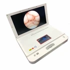 Hospital use 21 inch LCD screen ENT endoscope camera system
