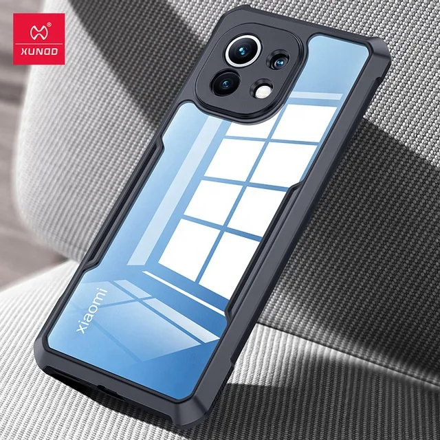 Xundd For Xiaomi Mi 11 Case With Shockproof Screen Protective Cover For Mi 11T 11 Ultra Poco M3 M4 Pro Case For Redmi 10
Xundd For Xiaomi Mi 11 Case With Shockproof Screen Protective Cover For Mi 11T 11 Ultra Poco M3 M4 Pro Case For Redmi 10