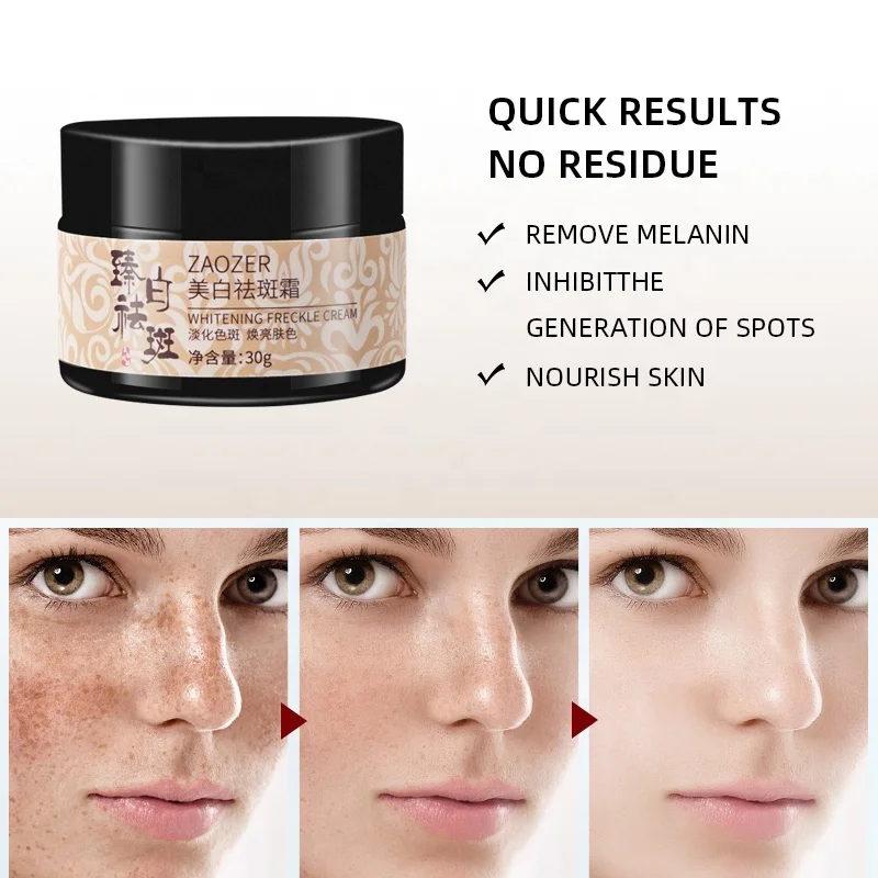 Calosemi 30g Beauty Korean Face Cream Anti-Freckle Dark Spot Removal Cream Freckle Whitening Cream
Calosemi 30g Beauty Korean Face Cream Anti-Freckle Dark Spot Removal Cream Freckle Whitening Cream