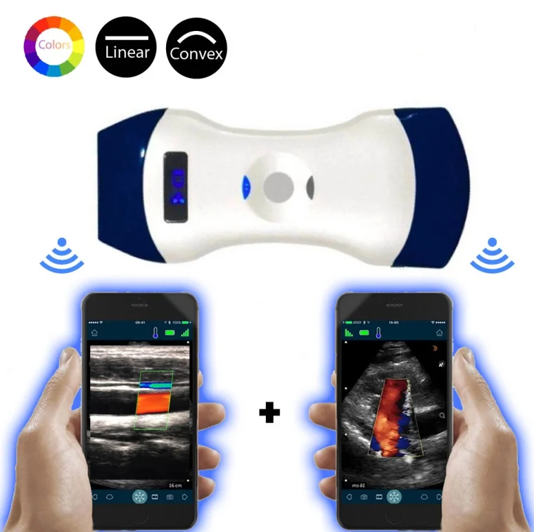 Convex Linear Probe Type Innovative Color Doppler Wireless Wifi Dual Head Mini Ultrasound