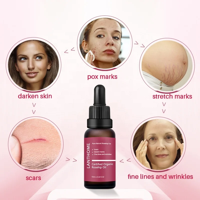 Lanthome Anti Scar Bulk Rosehip Oil Repair Stretch Marks Moisturizer Rosehip Essential Oil For Women
Lanthome Anti Scar Bulk Rosehip Oil Repair Stretch Marks Moisturizer Rosehip Essential Oil For Women