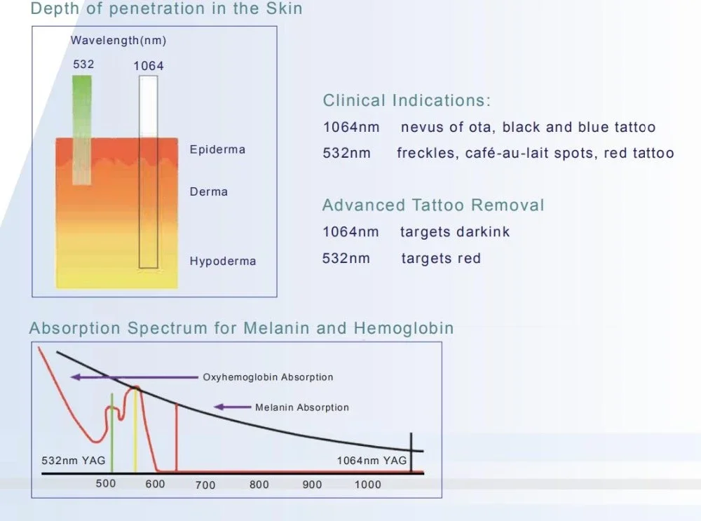 Purchasing Festival Beijing Sincoheren laser q switch 1064 532 tattoo removal beauty salon equipment