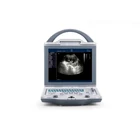 ZT-BW-U6 12inch LED Rotatable Screen Compact China Portable Ultrasound Machine Price