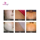 2020 Imported technology permanent hair removal, 808nm diode laser hair removal machine factory price