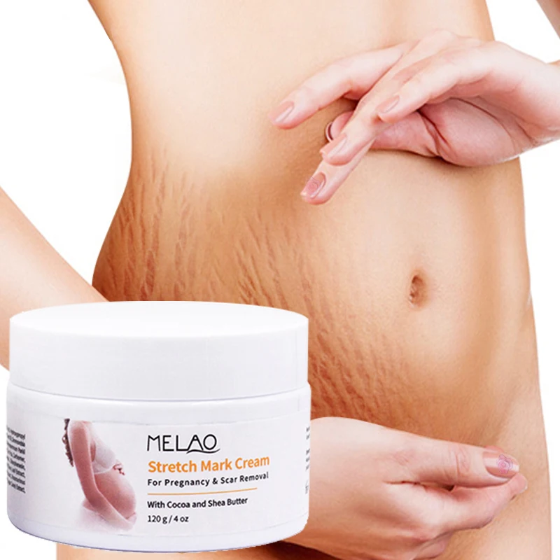 OEM ODM Private Label 100% Natural Vegan Maternity treatment Scar Removal Stretch Mark Cream
OEM ODM Private Label 100% Natural Vegan Maternity treatment Scar Removal Stretch Mark Cream