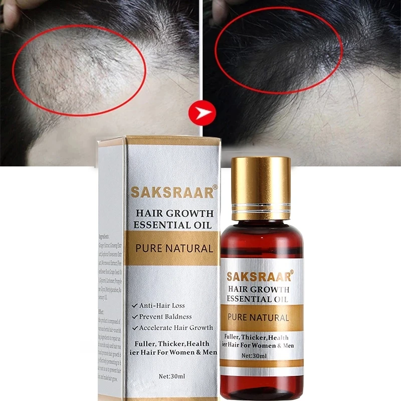 Hair Growth Essential Oil Original Factory 100% Natural Herb Safe Hair Loss Treatment Hair Regrowth Serum
Hair Growth Essential Oil Original Factory 100% Natural Herb Safe Hair Loss Treatment Hair Regrowth Serum