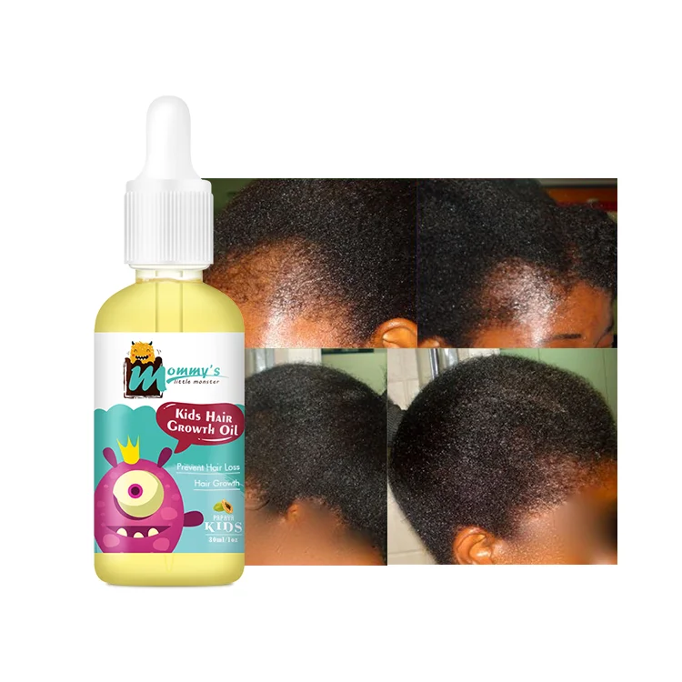 Mommy'S Little Monster Sultfate Free Cruetly Free Kids Baby Hair Growth Oil For Moisture And Nourish Scalp
Mommy'S Little Monster Sultfate Free Cruetly Free Kids Baby Hair Growth Oil For Moisture And Nourish Scalp
