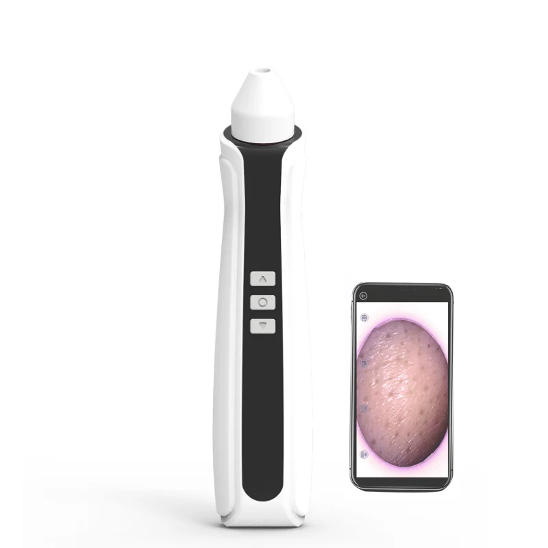 App Display WiFi Visual Suction Pore Vacuum Blackhead Remover With Camera Black Head Remover, White & black
App Display WiFi Visual Suction Pore Vacuum Blackhead Remover With Camera Black Head Remover, White & black