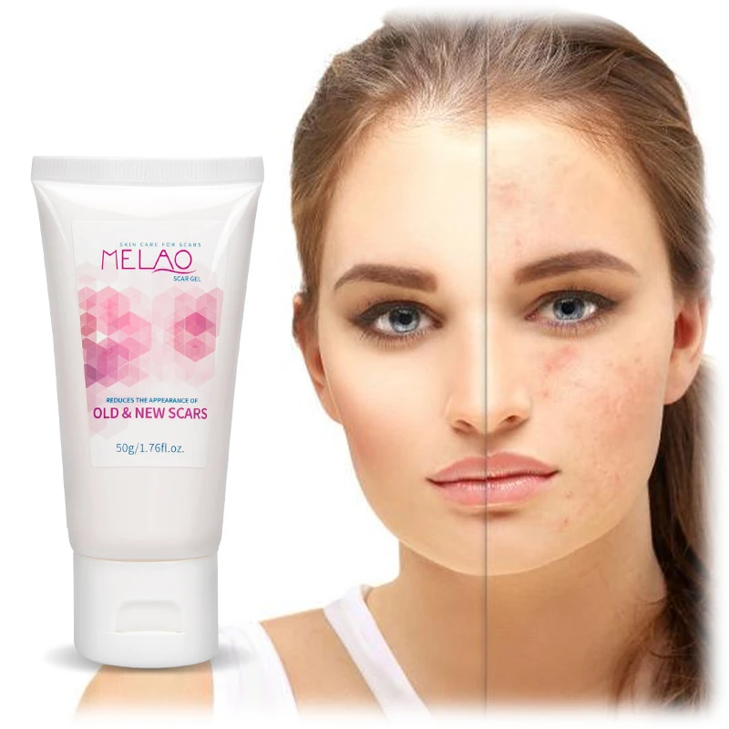 High Quality Private Label Wholesale Bulk 100% Organic Skin Care Beauty Scars Removal Cream Anti Scar Gel 
High Quality Private Label Wholesale Bulk 100% Organic Skin Care Beauty Scars Removal Cream Anti Scar Gel