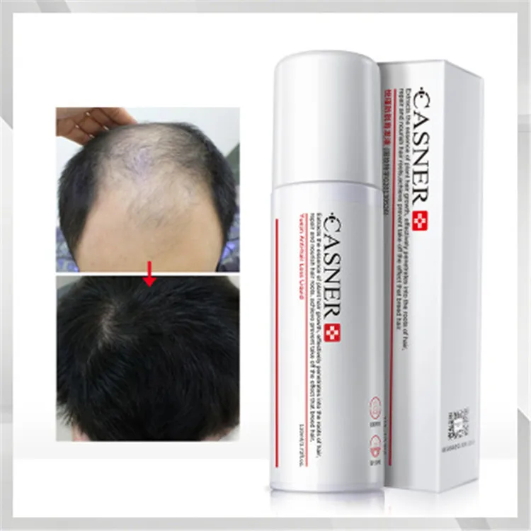 

Wholesale Private Label Organic Anti Hair Loss Oil Spray Thinning Hair Growth Serum For Hair Loss Treatment