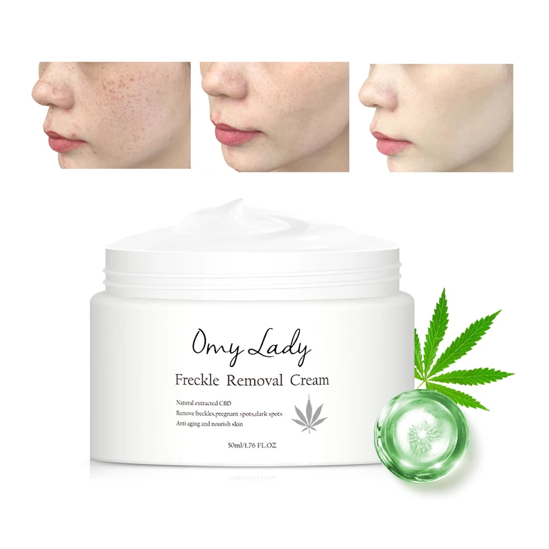 omy lady official store vegan friendly organic chaamomile skin care dark spot, freckle mark removal cream face
omy lady official store vegan friendly organic chaamomile skin care dark spot, freckle mark removal cream face