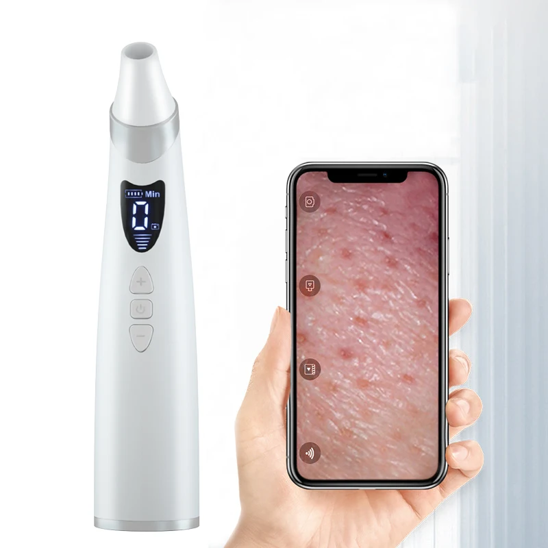 Best Seller Professional Visual Vacum Blackhead Remover Manufacture Nose Blackhead Remover, White
Best Seller Professional Visual Vacum Blackhead Remover Manufacture Nose Blackhead Remover, White
