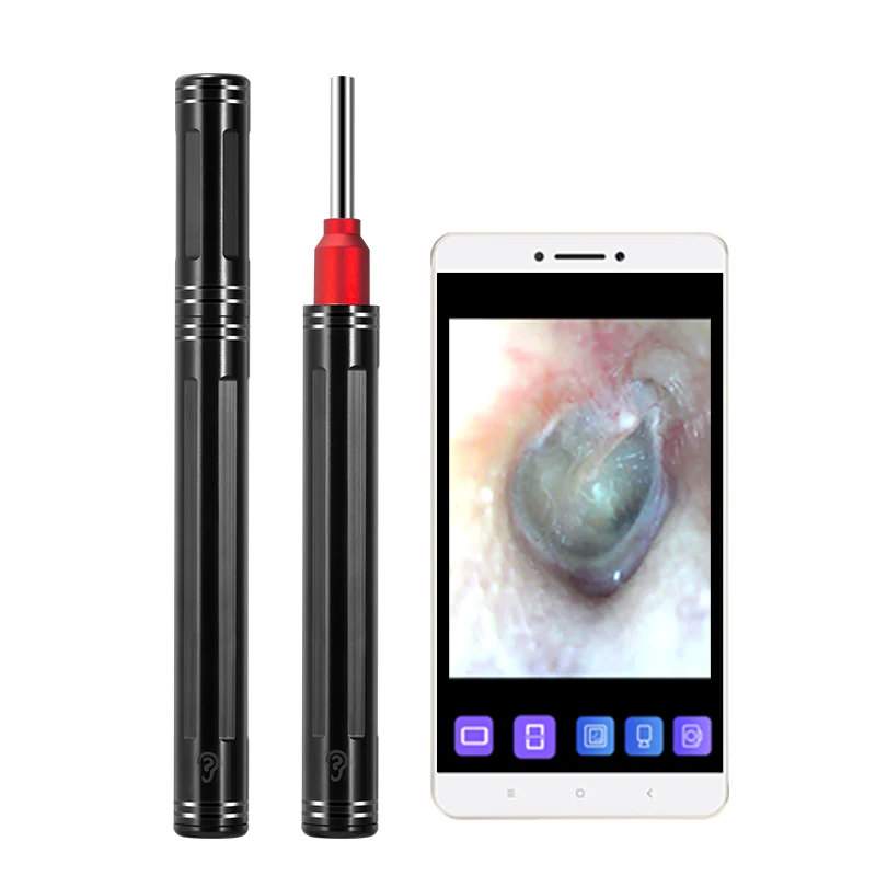 Electric Ear Pick Cleaner Kit 3.9mm HD Digital Wireless WIFI Otoscope Camera Earwax Remover, Black
Electric Ear Pick Cleaner Kit 3.9mm HD Digital Wireless WIFI Otoscope Camera Earwax Remover, Black