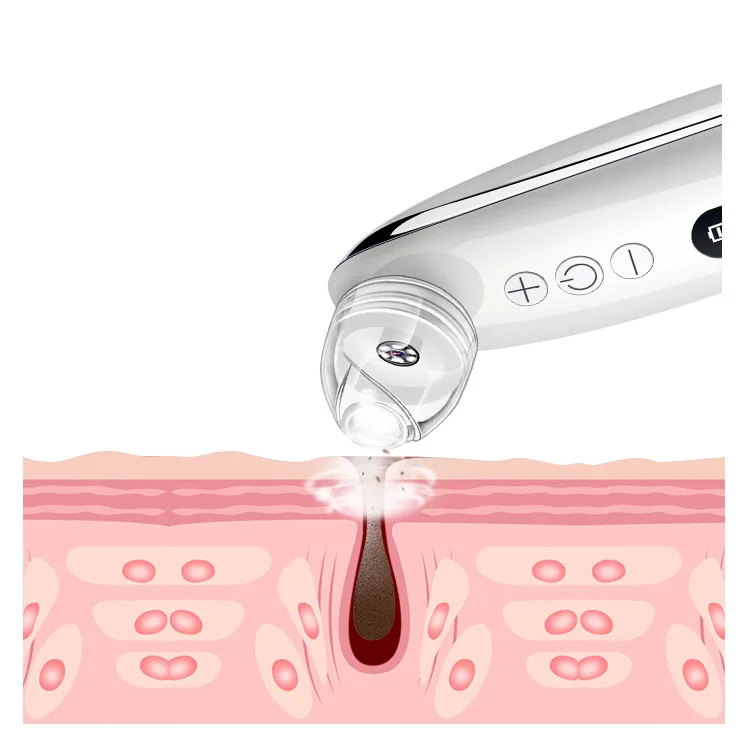Hot Selling Electric Black Head Remover Peel Tool Extractor Blackhead Remover Vacuum Blackhead Removal, White
Hot Selling Electric Black Head Remover Peel Tool Extractor Blackhead Remover Vacuum Blackhead Removal, White