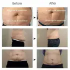 Ce 承認-5 度減量セールベストプライススリミングクライオ脂肪凍結最高のポータブル Cryolipolysis マシン