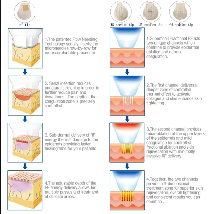 2020 trending product fractional rf microneedle machine for stretch mark acne wrinkle removal