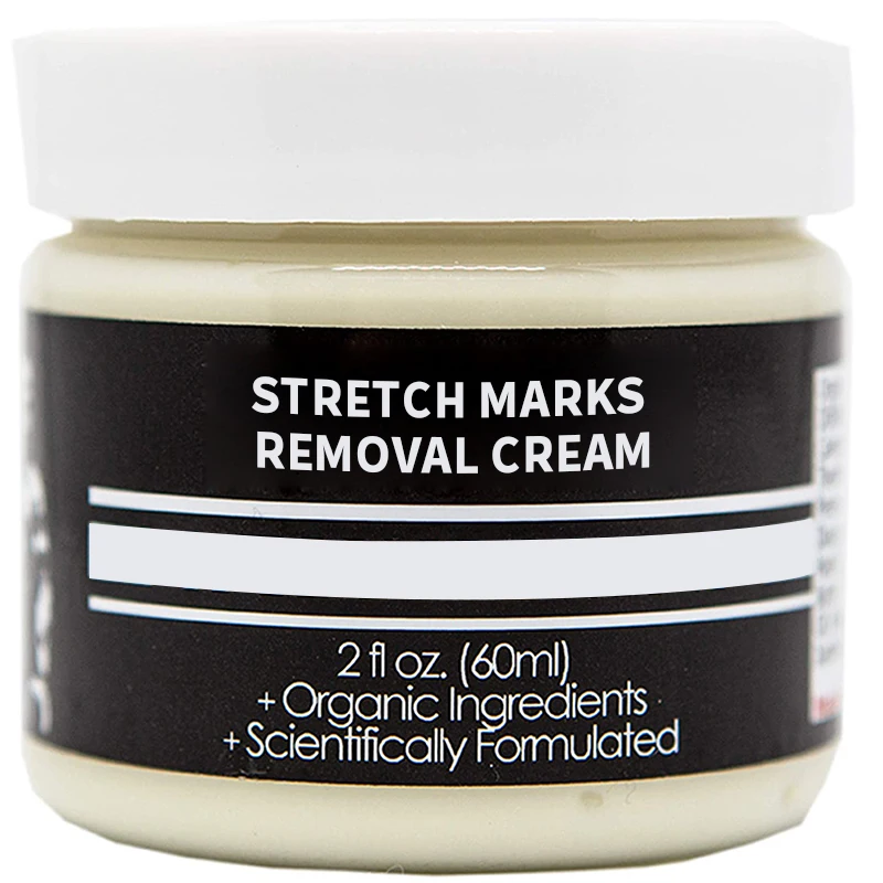 Korea Cosmetics High Quality Obesity Pattern Repair Cream Relief Stretch Marks Removed Cream And Oil Remover With Custom Logo
Korea Cosmetics High Quality Obesity Pattern Repair Cream Relief Stretch Marks Removed Cream And Oil Remover With Custom Logo