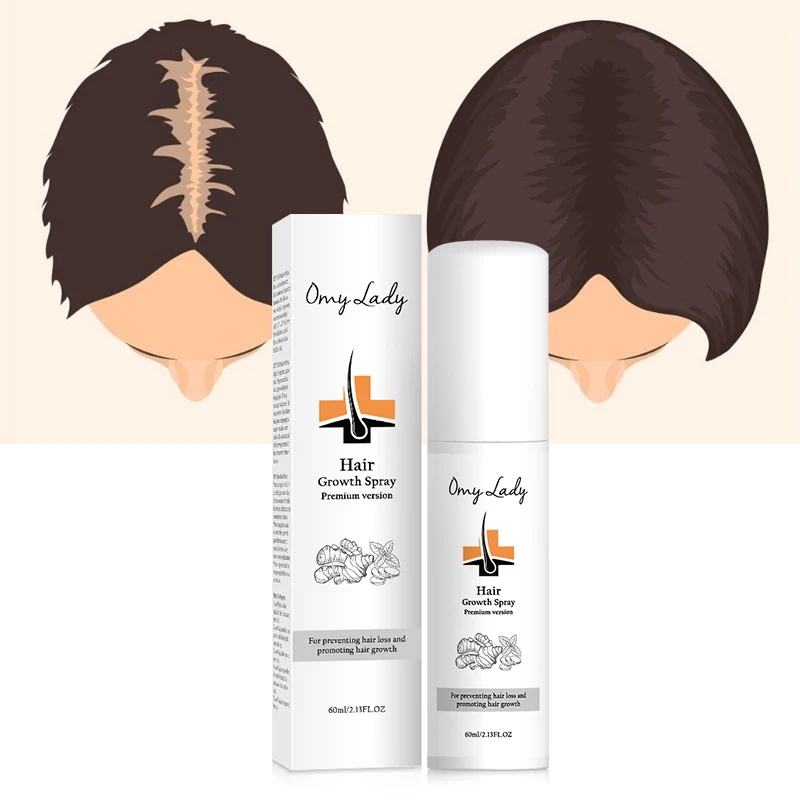 Best Selling Products Sample In USA OMY LADY Anti Hair Fungal Bald Hair Regrowth Serum
Best Selling Products Sample In USA OMY LADY Anti Hair Fungal Bald Hair Regrowth Serum
