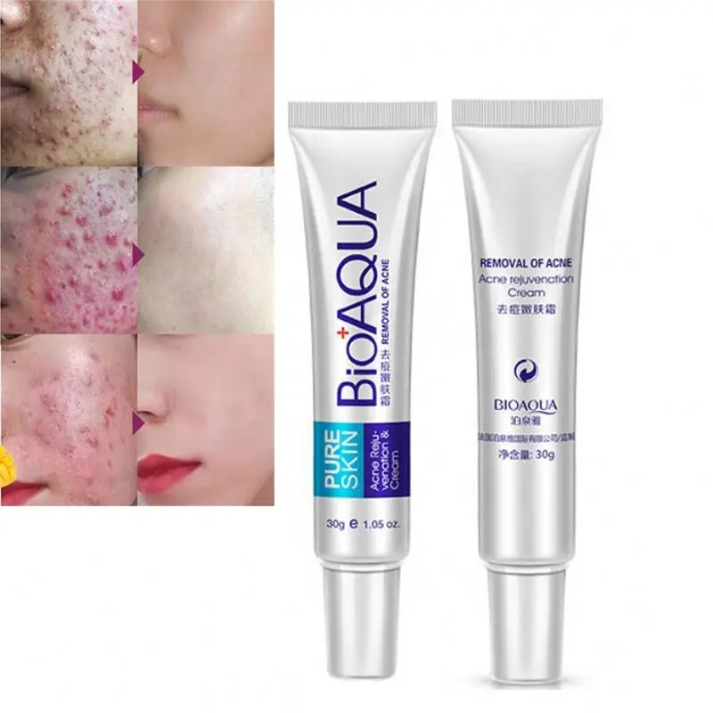 BIOAQUA Moisturizing Face Cream Skin Care Acne Treatment Cream
BIOAQUA Moisturizing Face Cream Skin Care Acne Treatment Cream
