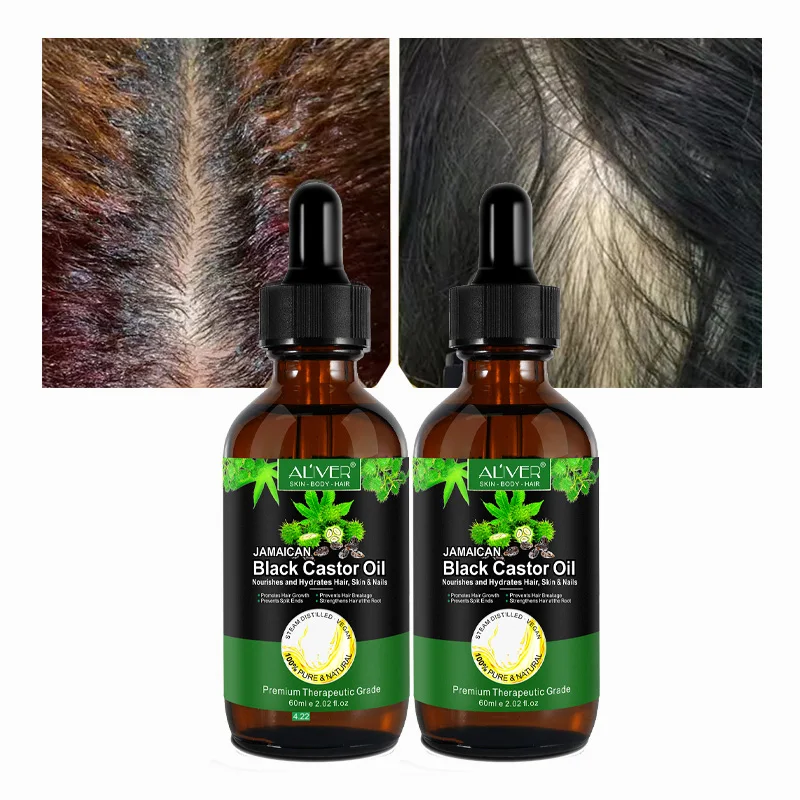 

100% Pure Natural Organic Hair Treatment Oil Hair Loss Thinning Hair Growth Serum Jamaican Black Castor Oil