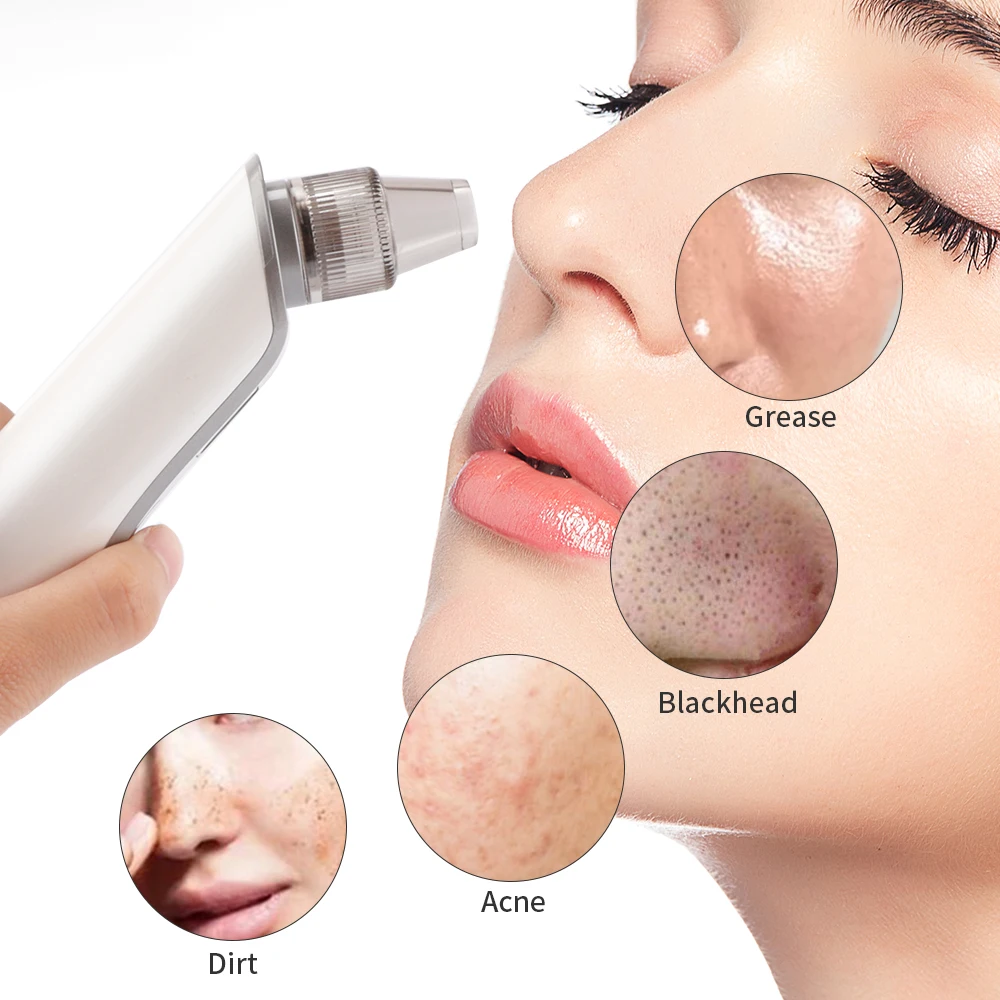 red light blackhead removal blue light blackhead removal electric blackhead remover, White
red light blackhead removal blue light blackhead removal electric blackhead remover, White