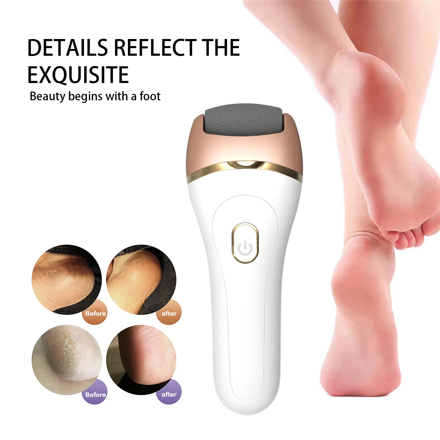Easy to carry Waterproof foot polisher 2nd speed governor peeler Private label Electric foot grinder, Black, gold, white
Easy to carry Waterproof foot polisher 2nd speed governor peeler Private label Electric foot grinder, Black, gold, white