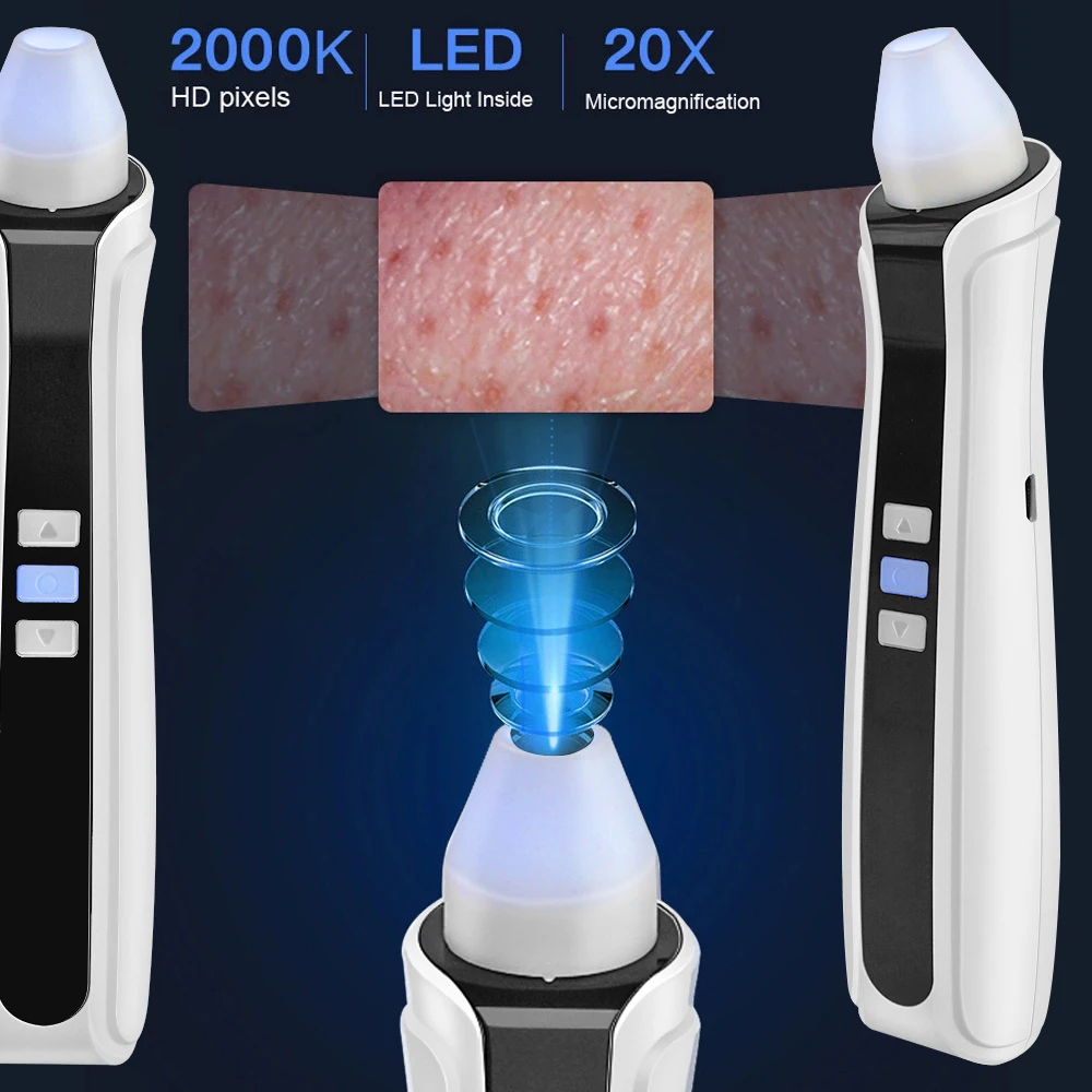 Wireless Wifi Intelligent Microscope Camera Compatible Visual Vacuum Blackhead Meter Remover, White
Wireless Wifi Intelligent Microscope Camera Compatible Visual Vacuum Blackhead Meter Remover, White