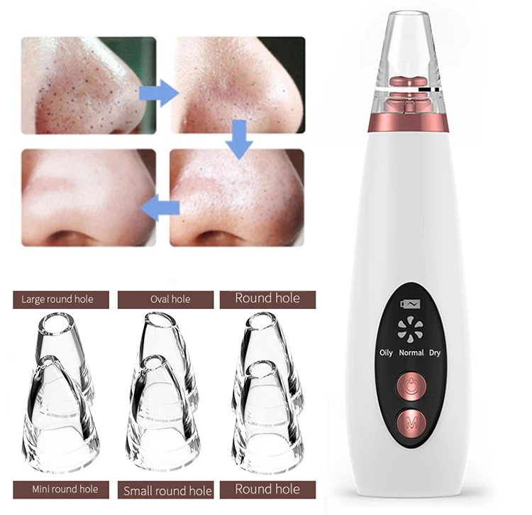 Blackhead Remover Vacuum 4 in 1 Facial Extractor with Led Display for Women/Men all kind of skin
Blackhead Remover Vacuum 4 in 1 Facial Extractor with Led Display for Women/Men all kind of skin