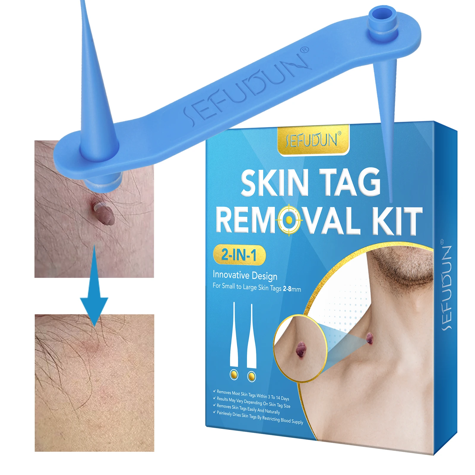 

Private Label 2 In 1 Skin Tag Removal Kit Helps Remove Warts Acne Moles Facial Body Skin Tag Remover