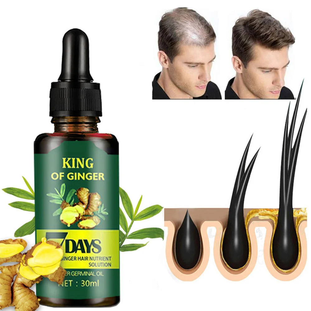 Free Sample 30ML Ginger Hair Oil Mega Growth Healthy Hair Growth Stimulating Oil