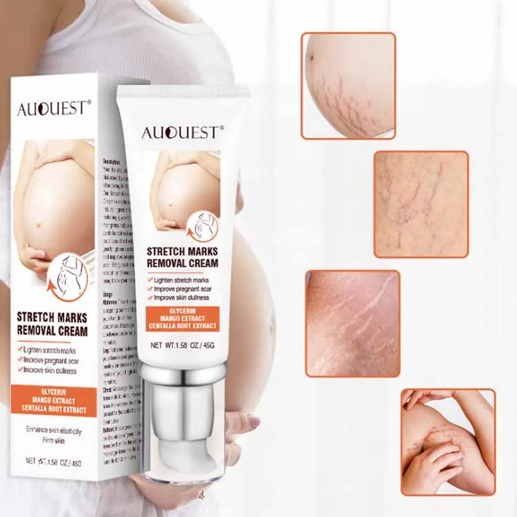 Private Label Scar Acne Removal Cream Fade Deep Scar Pigment Face Body Stretch Mark Scar Removal Cream, White color
Private Label Scar Acne Removal Cream Fade Deep Scar Pigment Face Body Stretch Mark Scar Removal Cream, White color