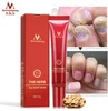 MeiyanQiong Foot Nail Cream Protector Skin Care Cream Nail Fungus Treatment Herb Anti Fungal Nail Repair Cream